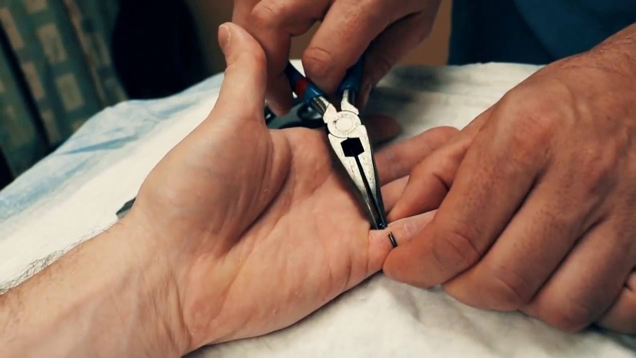 Ring Removal with Raptor Trauma Shears