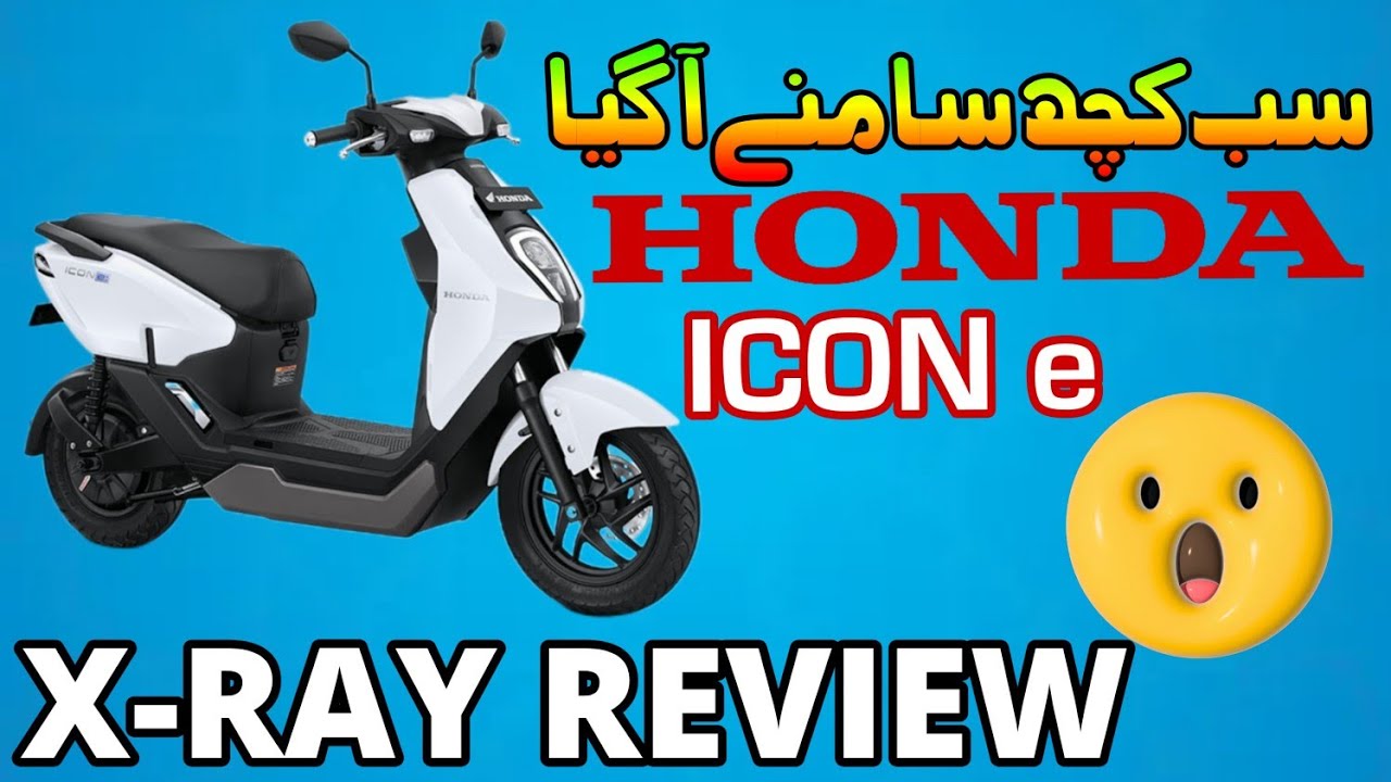 Honda Icon E X-RAY REVIEW