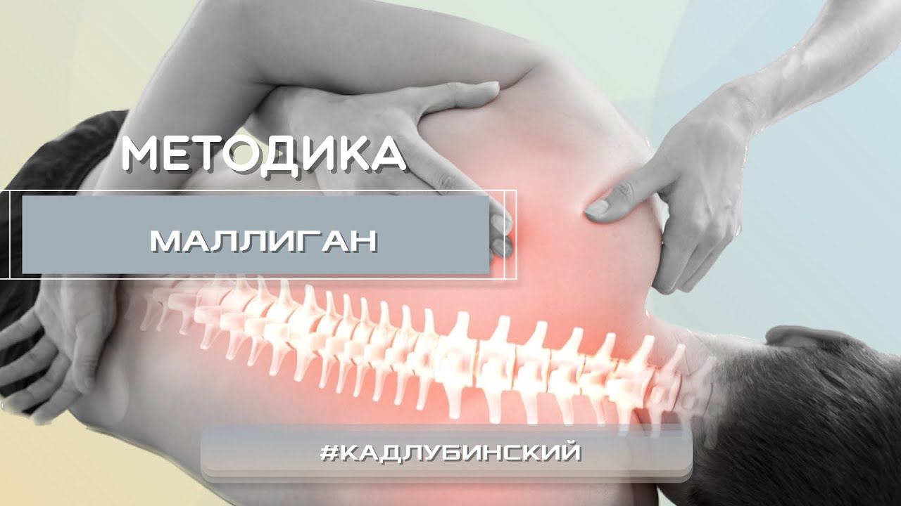 Методика Маллиган
