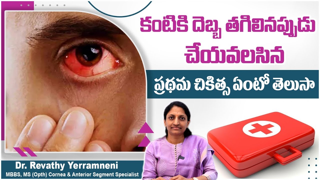 Eye Injuries Types || Eye Care Tips in Telugu || First Aid for Eye Injury || Smartvision