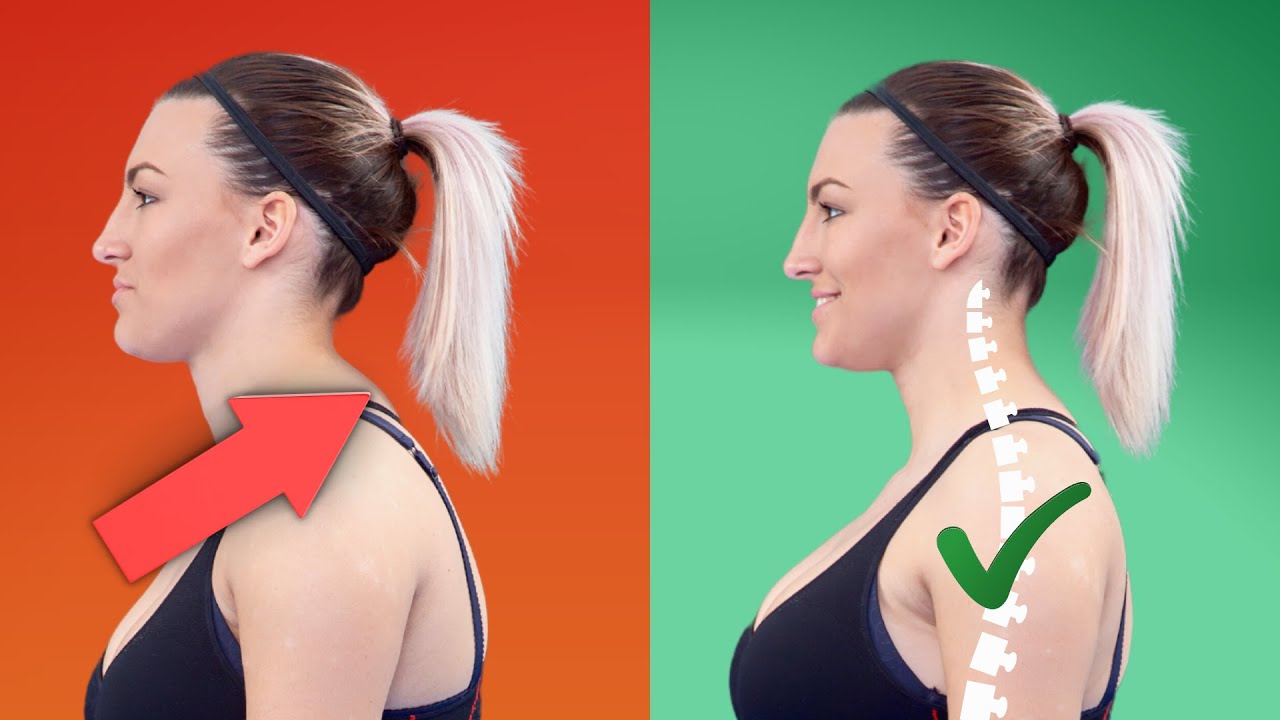 Fix Hunchback Posture While You Sleep | 4 Easy Tips to Reverse Dowager’s Hump Naturally