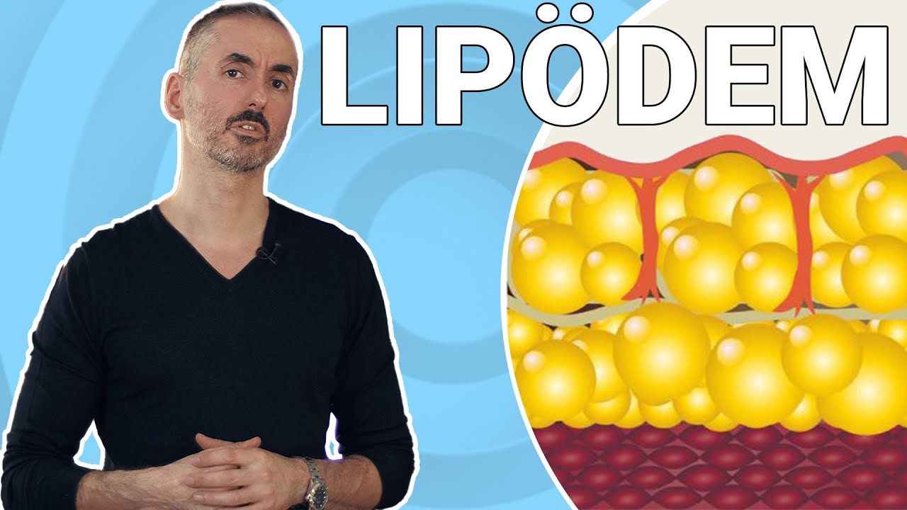 Dein Plastic Surgery Coach – Lipödem – Infos und Hilfe