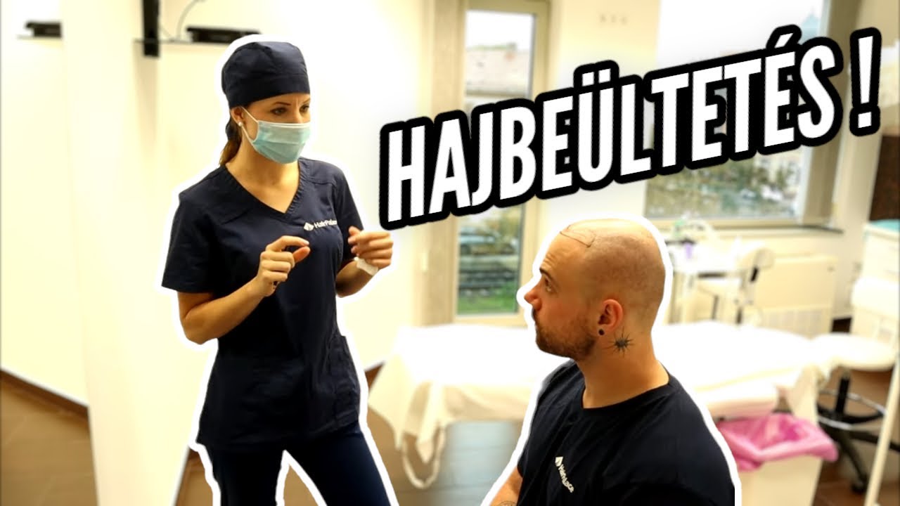HAJBEÜLTETÉS-re mentem! / Így néz ki egy hajbeültetés!