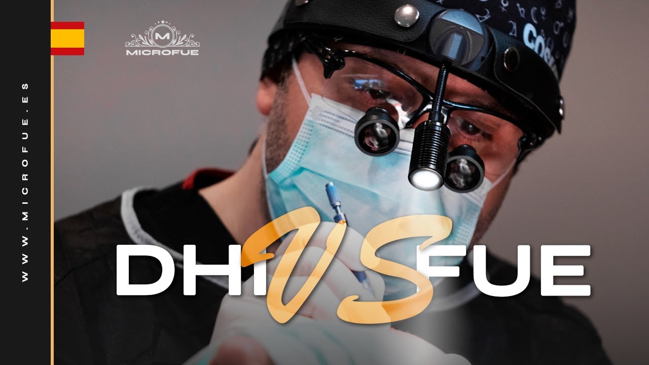 🇪🇸 Trasplante de pelo DHI vs FUE - la verdadera diferencia entre las dos técnicas