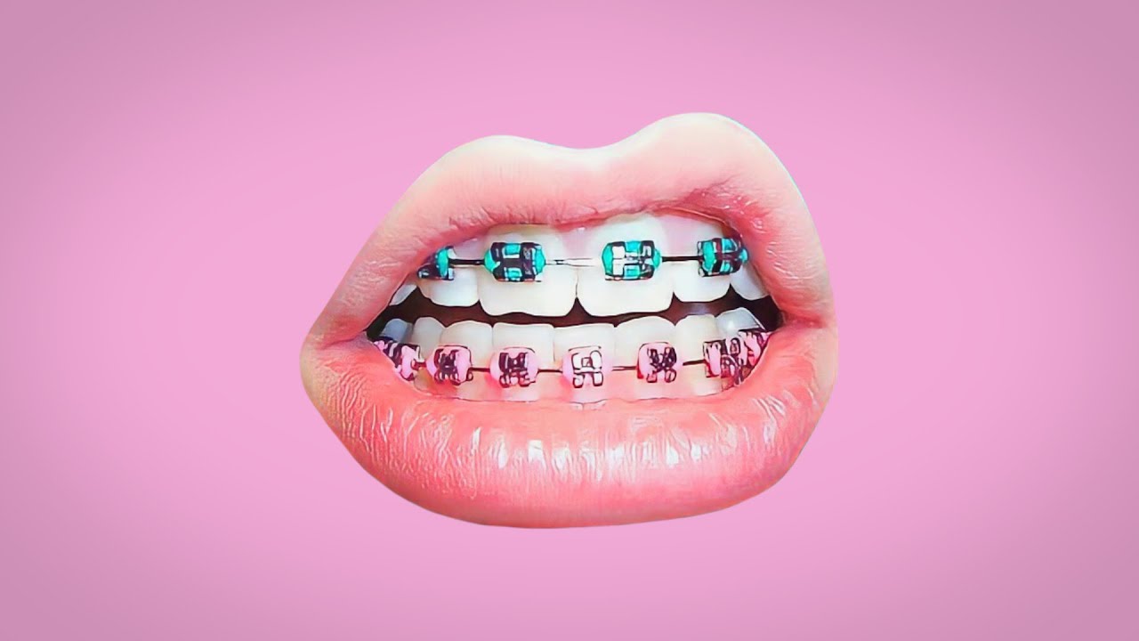 *FREE* Tyga Type Beat - 