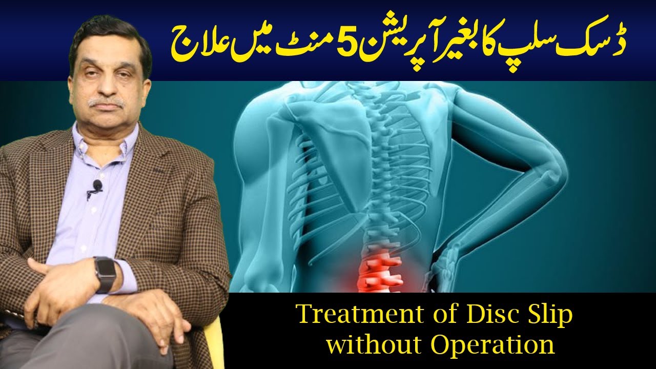Treatment of Disc Slip without Operation in Just Five Min|Dr. Shahzad Kareem Bhatti  |  Ozone Clinic