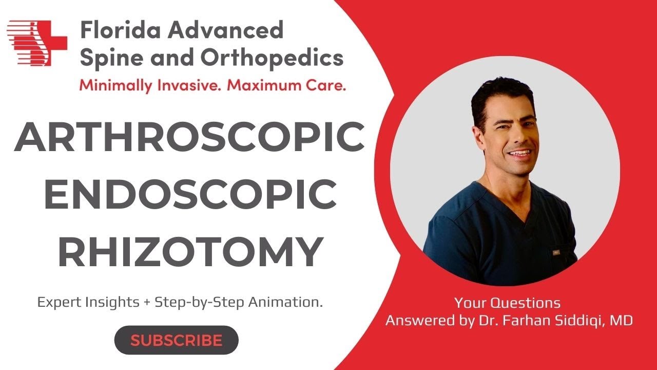 Endoscopic Rhizotomy: The Secret to Long-Lasting Back Pain Relief?