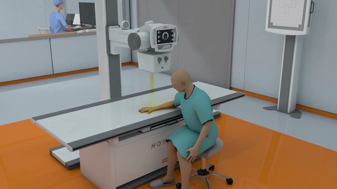 Carestream  | Horizon  X-Ray System