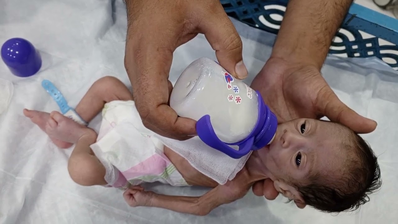 Preterm Baby Feeding Guide | Step-by-Step Bottle Feeding in NICU Care