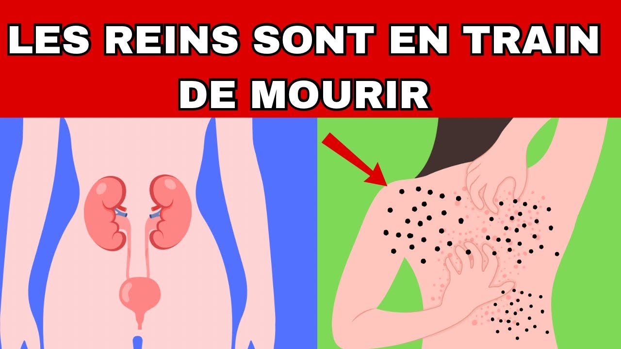 10 Signes Que Vos Reins Demandent de l'Aide: N'ignorez Jamais Ces Symptômes de Problèmes Rénaux