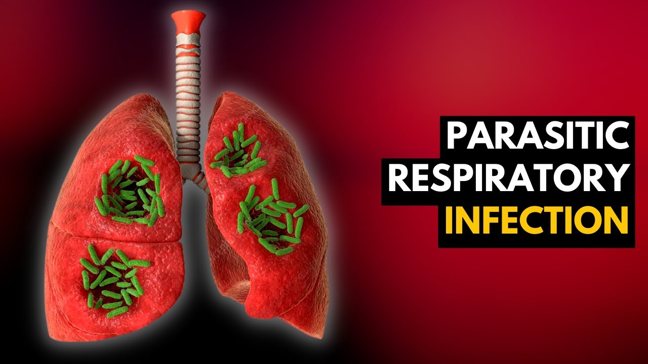 Parasitic Respiratory Infection: What Is This And How Do You Treat It