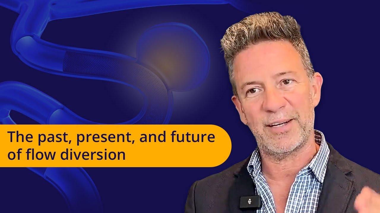 The Past, present, and future of Flow Diversion: Insights from Hal Rice