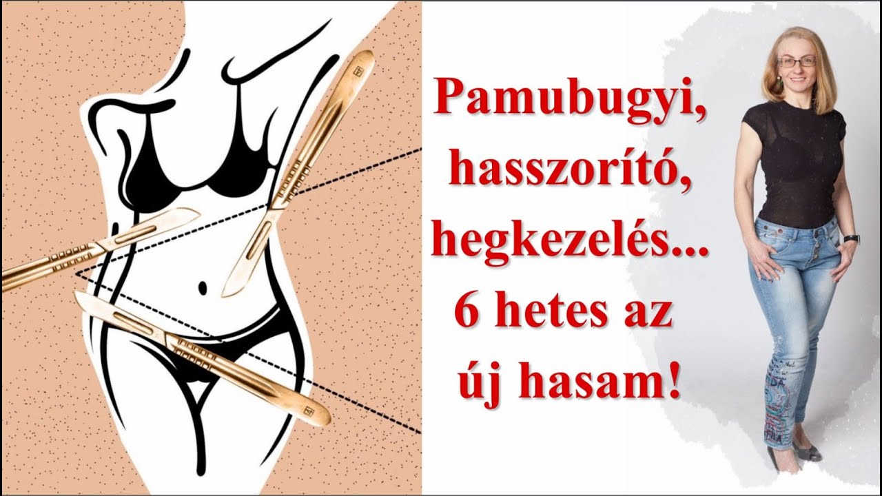 Kezdődik a hegkezelés! - 6 héttel hasplasztika után íme a pocakom!