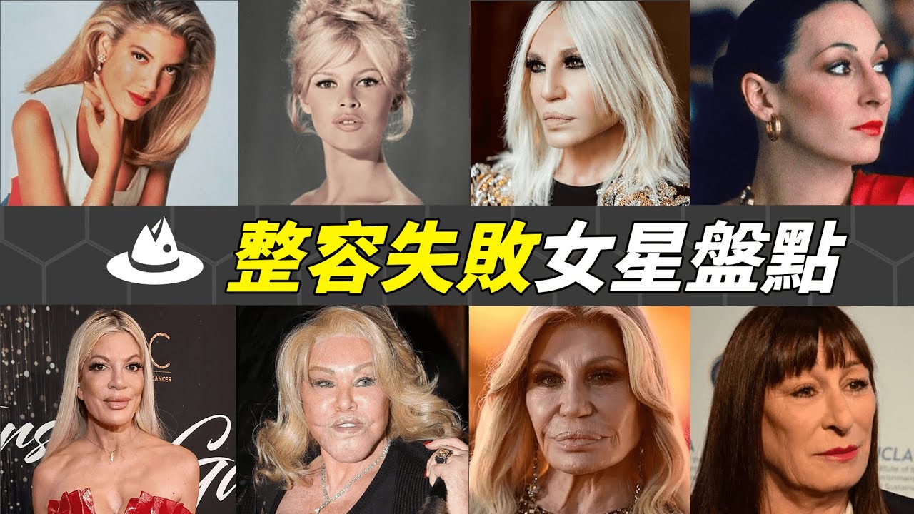 歐美女星整容失敗下場有多慘？不僅面目全非容貌盡毀，甚至因形象太醜遭業界封殺！|#魚樂說 #娛樂 #明星 #人物誌