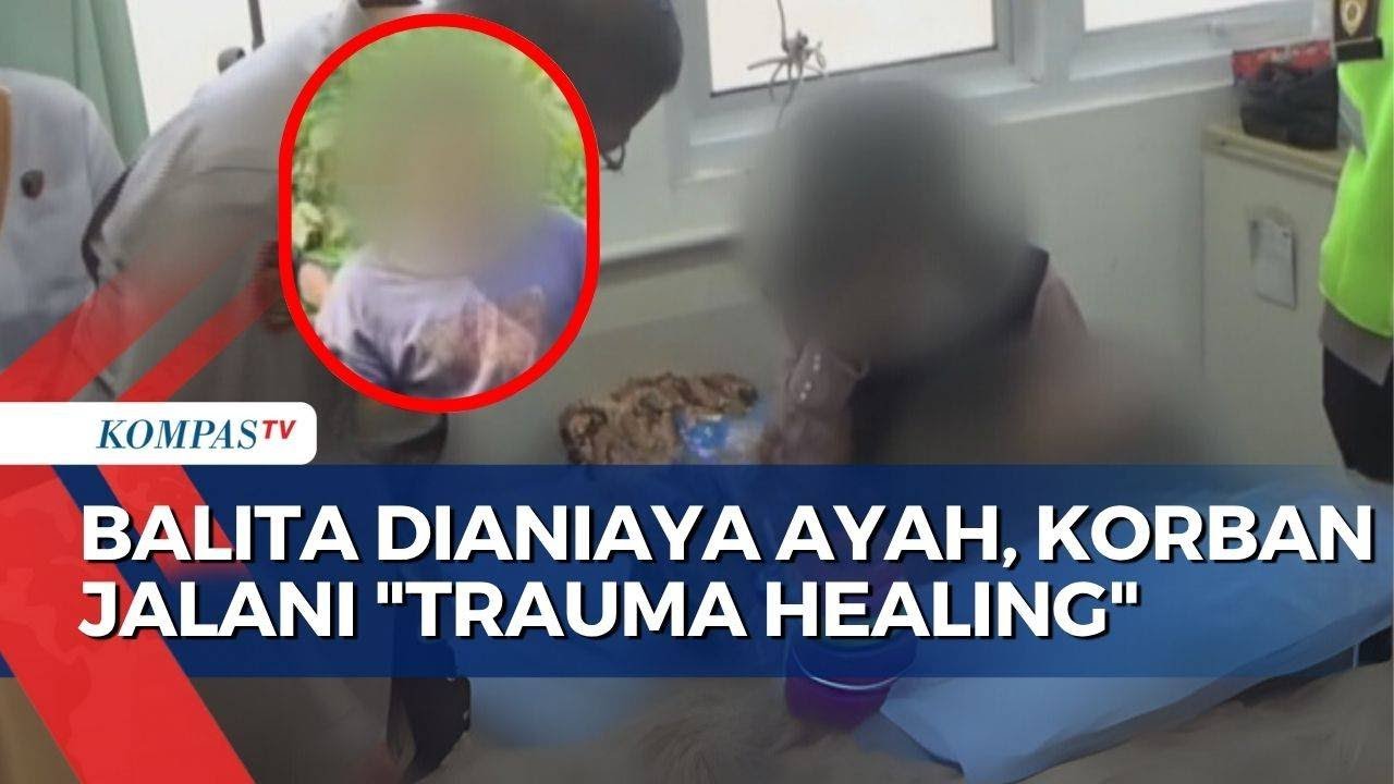 Balita di Purwakarta Disiksa Ayah karena Ibunya Minta Cerai, Kini Jalani Trauma Healing