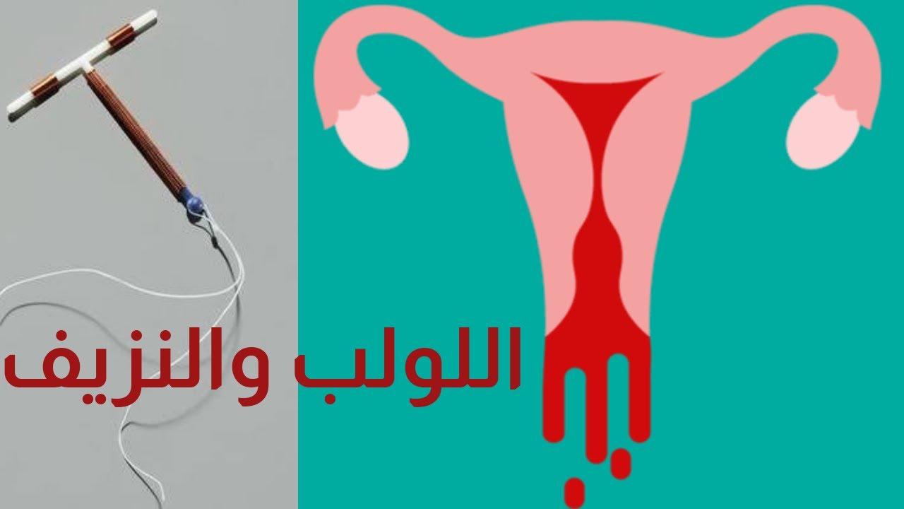 الحل المثالى لمشكلة النزيف مع اللولب
