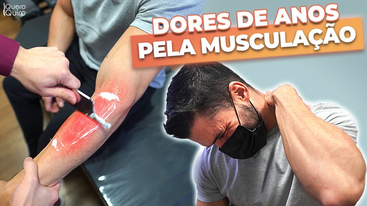 DOR CERVICAL, BRAÇO E COTOVELO | QUIROPRAXIA + LIBERAÇÃO MIOFASCIAL