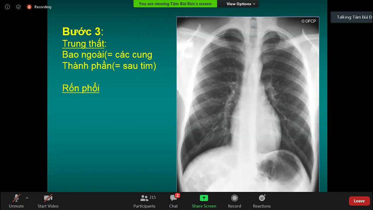Hướng dẫn đọc X-Quang tim phổi - TS. BS. Phan Thu Phương YHN