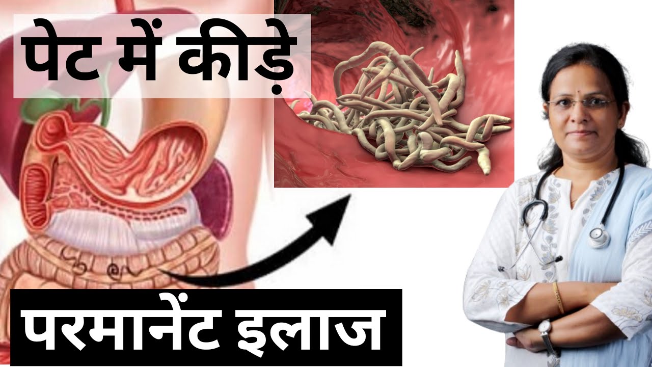 Stomach Worms Symptoms | Symptoms, causes and medicine of worms in the stomach | Ayurvedic treatm...
