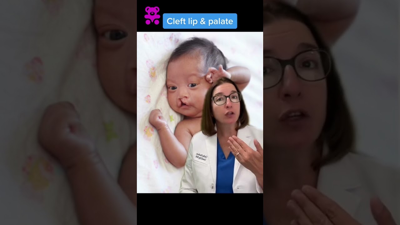 Cleft Lip & Palate: Pediatrics 🧸 SHORT | @LevelUpRN