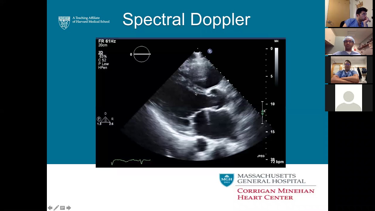 Cardiac Surgery Didactics—Basics of Echocardiography