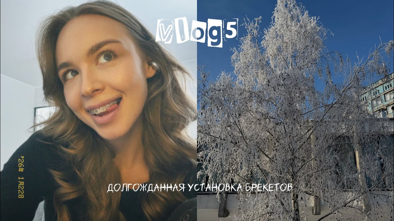 vlog5: установка брекетов | мои ощущения | покупки для ухода | мои варианты японского чизкейка