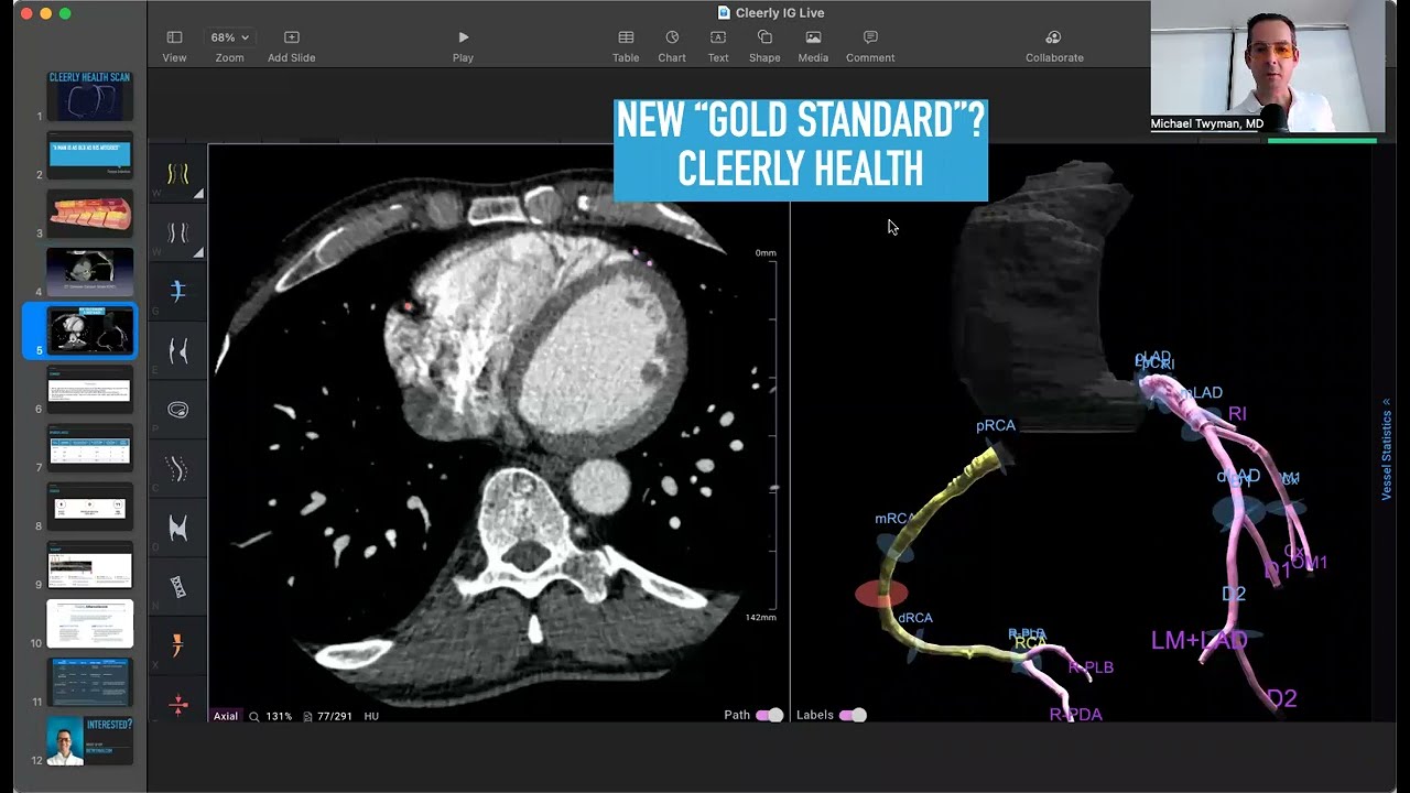 Cleerly Scan - Do you have 