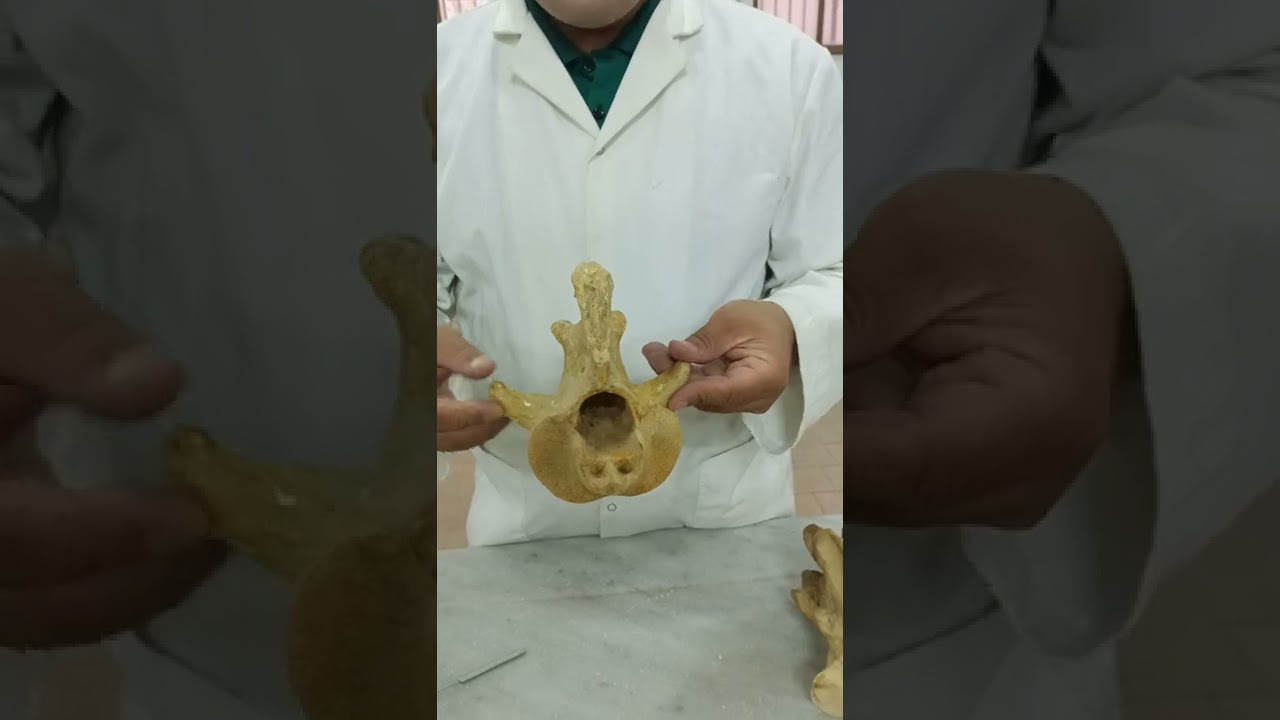 2nd cervical vertebrae (Axis) comparative دكتور رمضان ساري