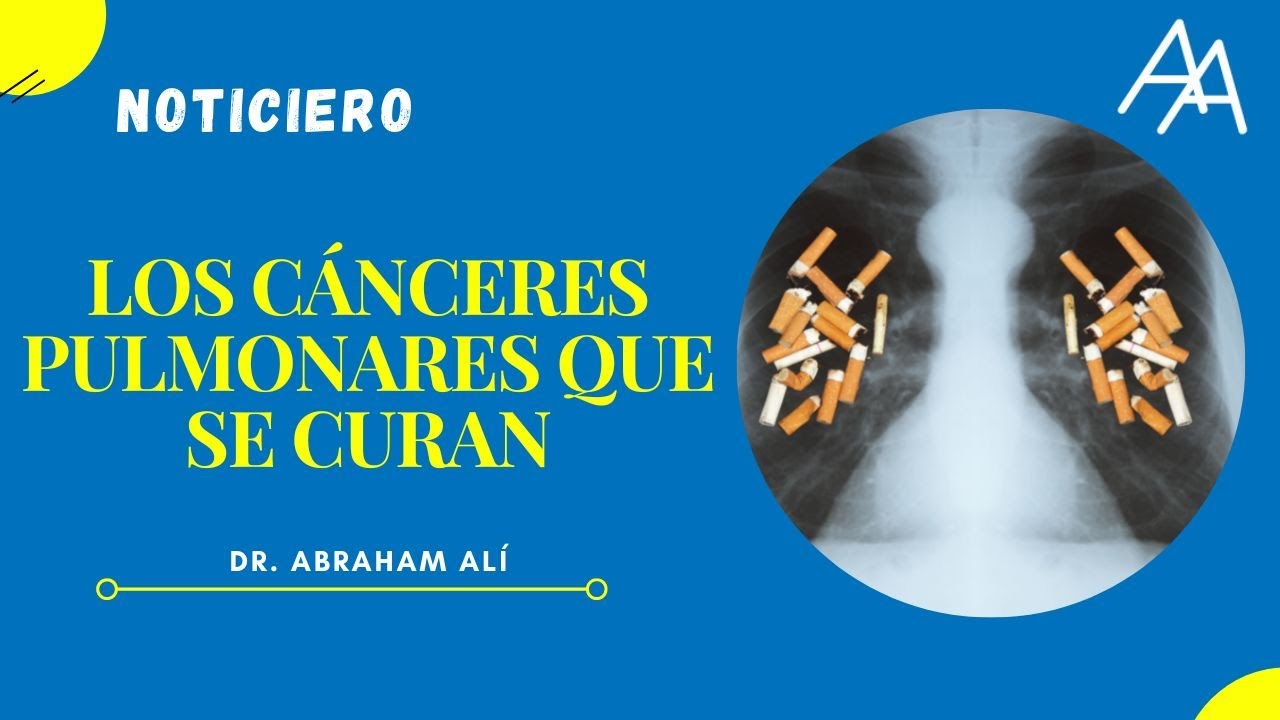 Noticiero Marzo 2023 "Los Cánceres Pulmonares que se curan"
