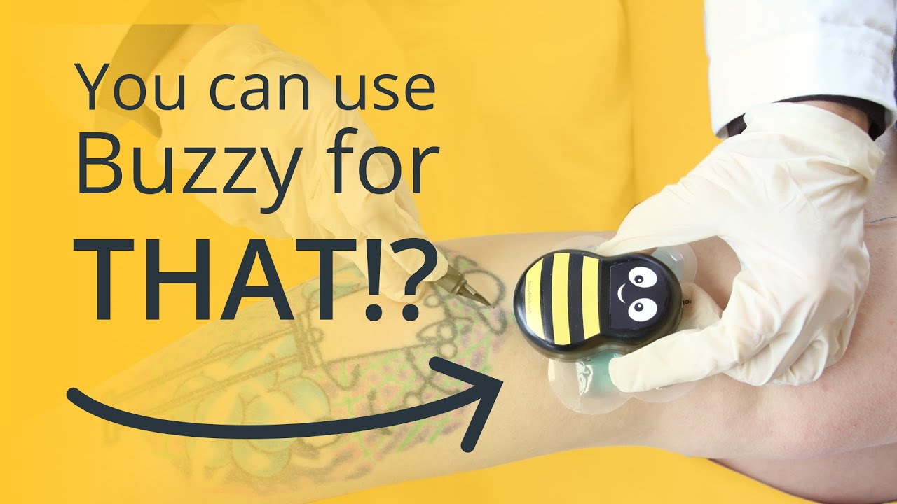 10 Things You Didn't Know You Could Do with Buzzy | Beyond Needles