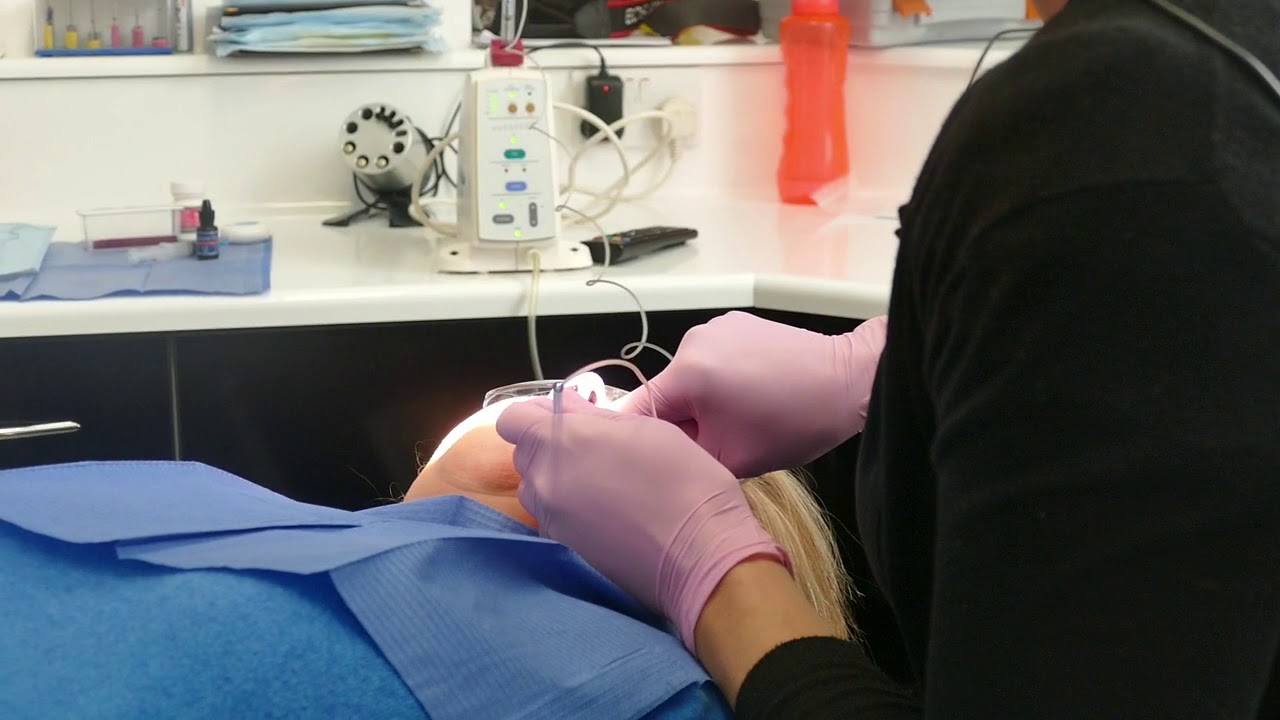 The Dental Wand Explained | Fear of Injections