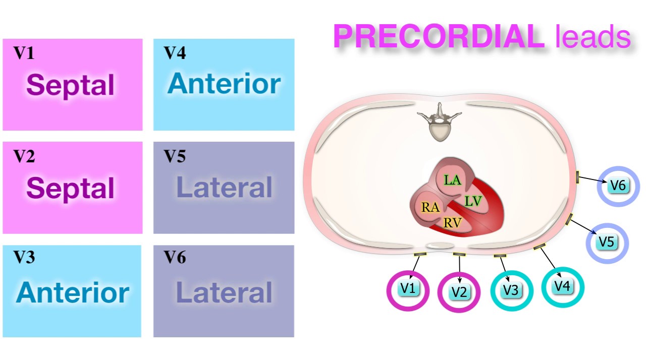Ischemia 3/7 - Localization on ECG