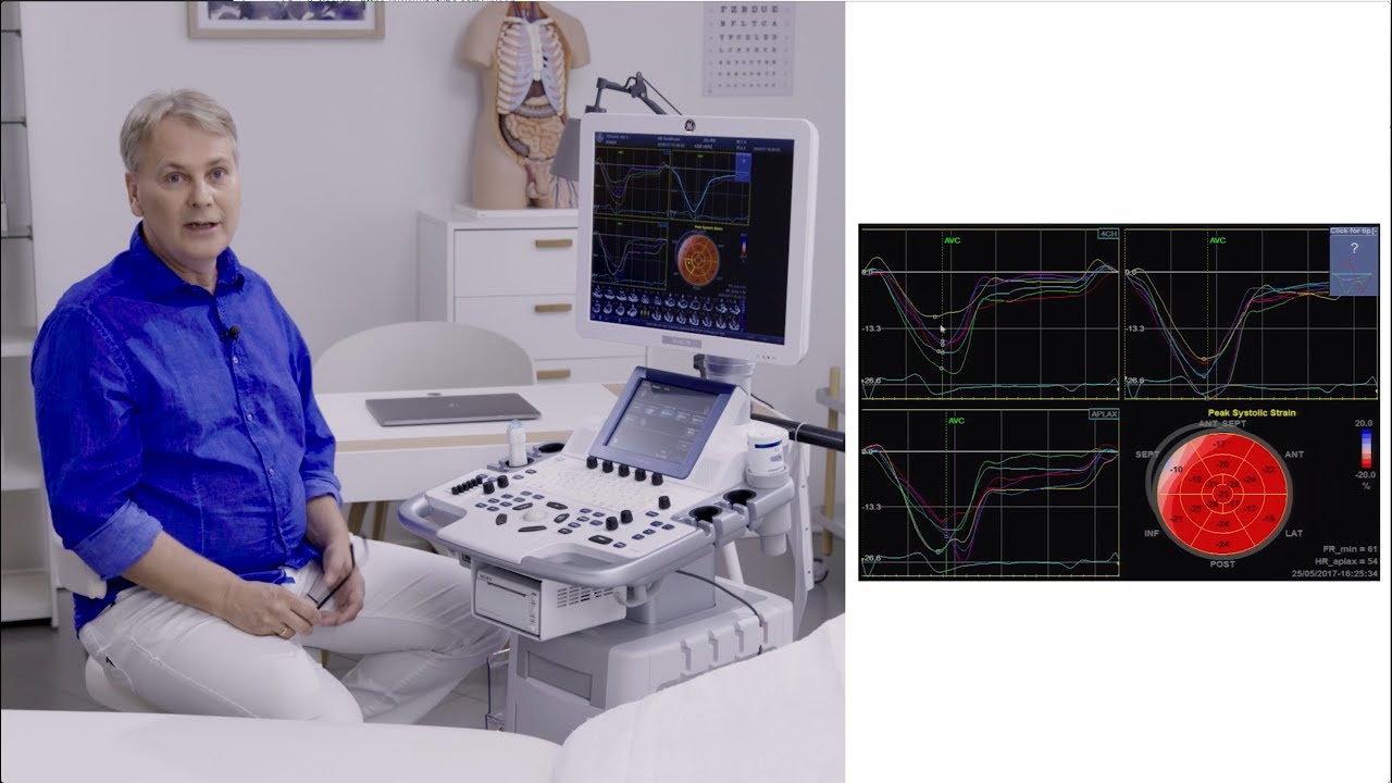 Speckle Tracking MasterClass