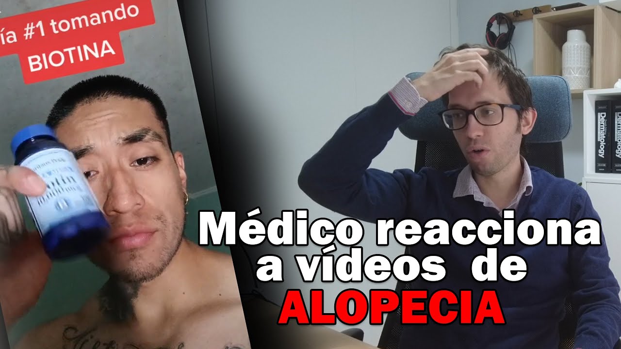 Medico reacciona a videos de ALOPECIA