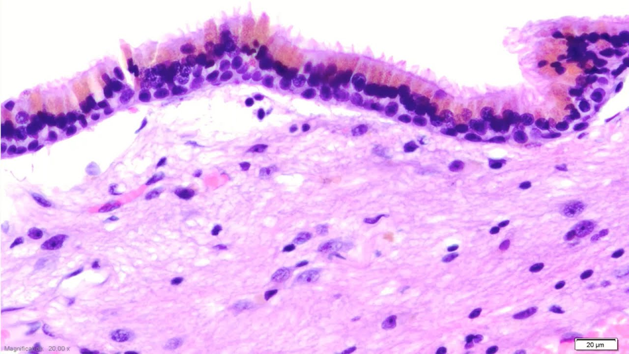 Caso 45 | Pathologists Online
