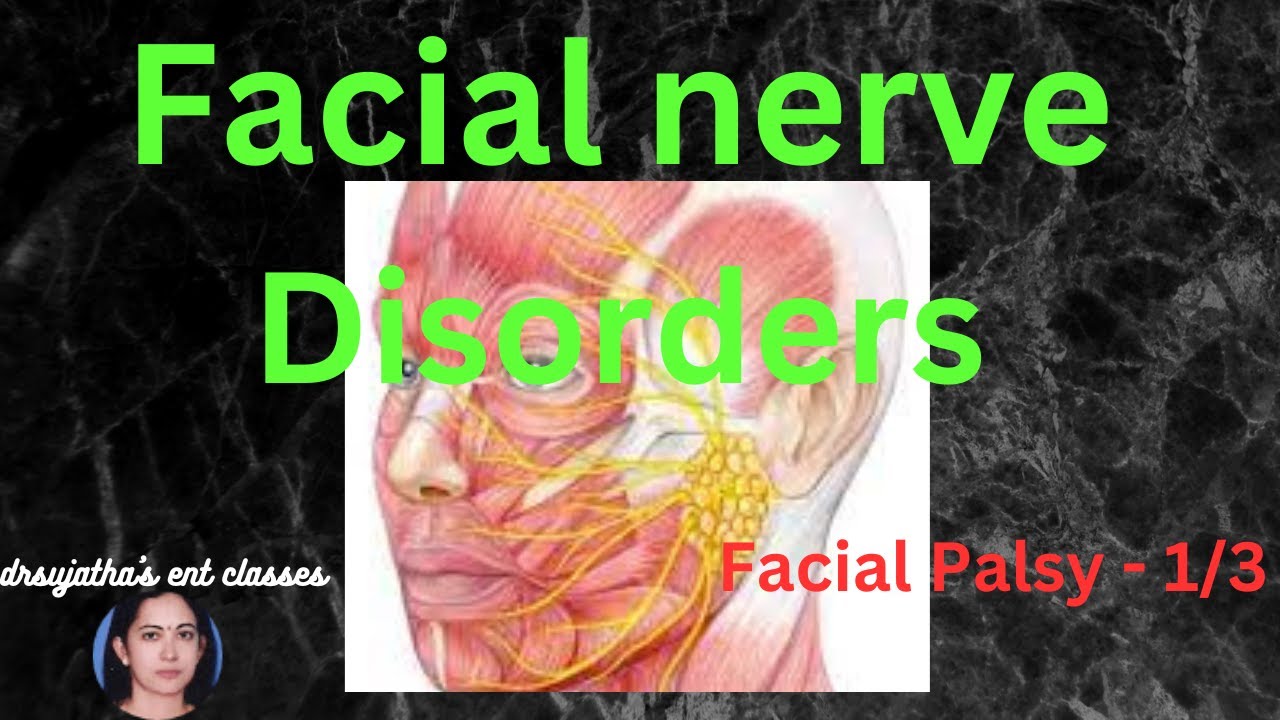 029. Facial Nerve Disorders : Part 1/3  #facialpalsy