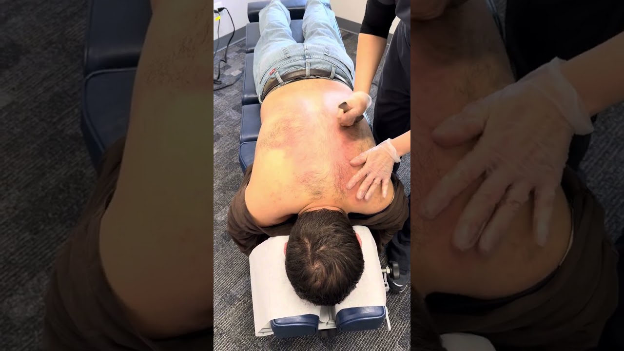 Gua Sha treatment #guashatherapy #chiropractic #asmr #trending