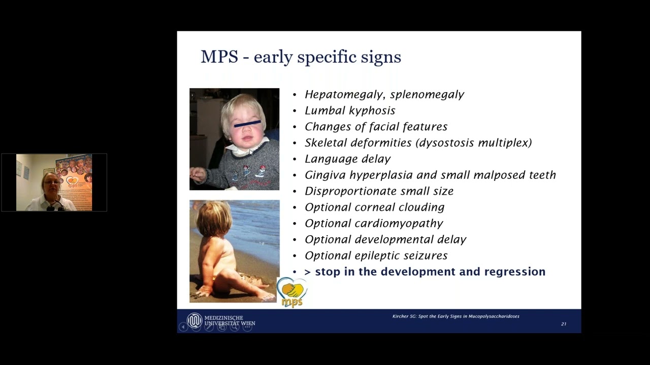 Spot the Early Signs of Mucopolysaccharidoses  One Disease with Many Faces