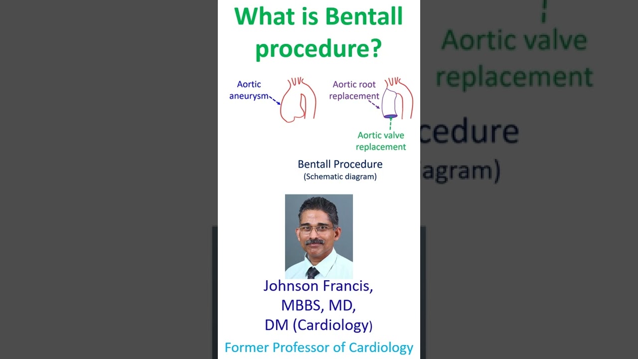 What is Bentall procedure?