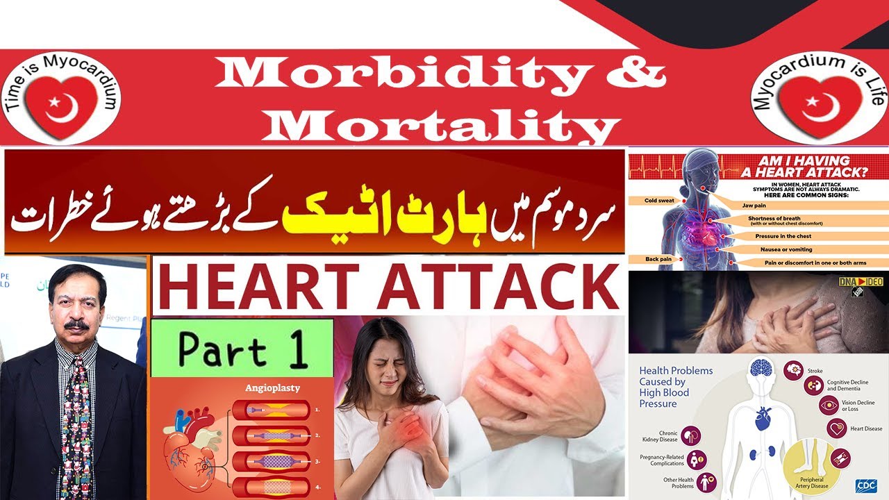 Dr. Asadullah Khan Soomro,330 Heart Attack Patients High Morbidity and Mortality in Diabetic women.