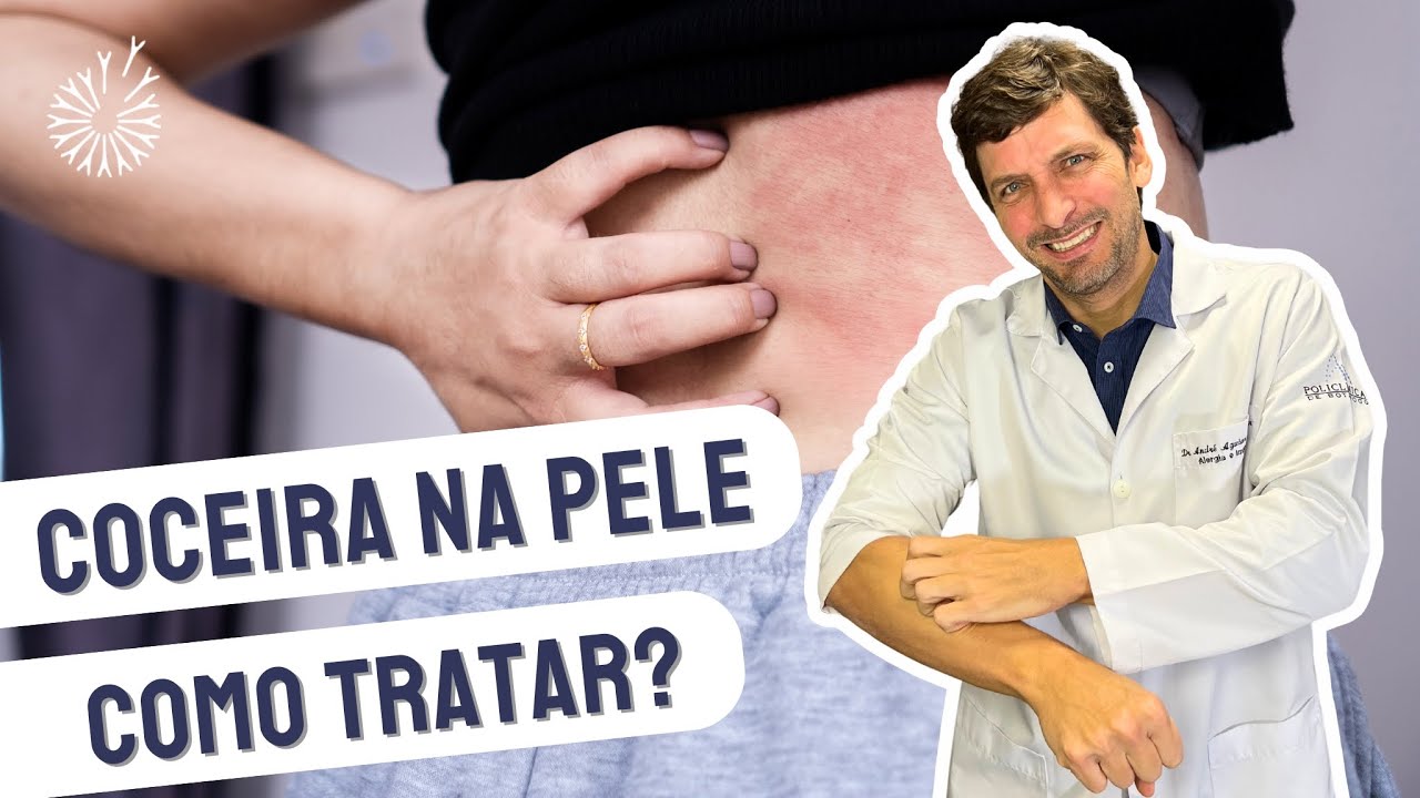 7 CAUSAS DE COCEIRA NA PELE E COMO TRATAR #coceira #dermatite #urticaria