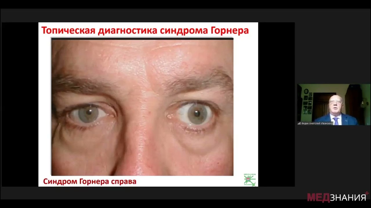 18  Трудный пациент Клин случаи 05 11