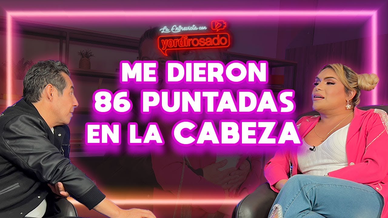 ME ATROPELLÓ y se regresó a REMATARME | Wendy Guevara | La entrevista con Yordi Rosado