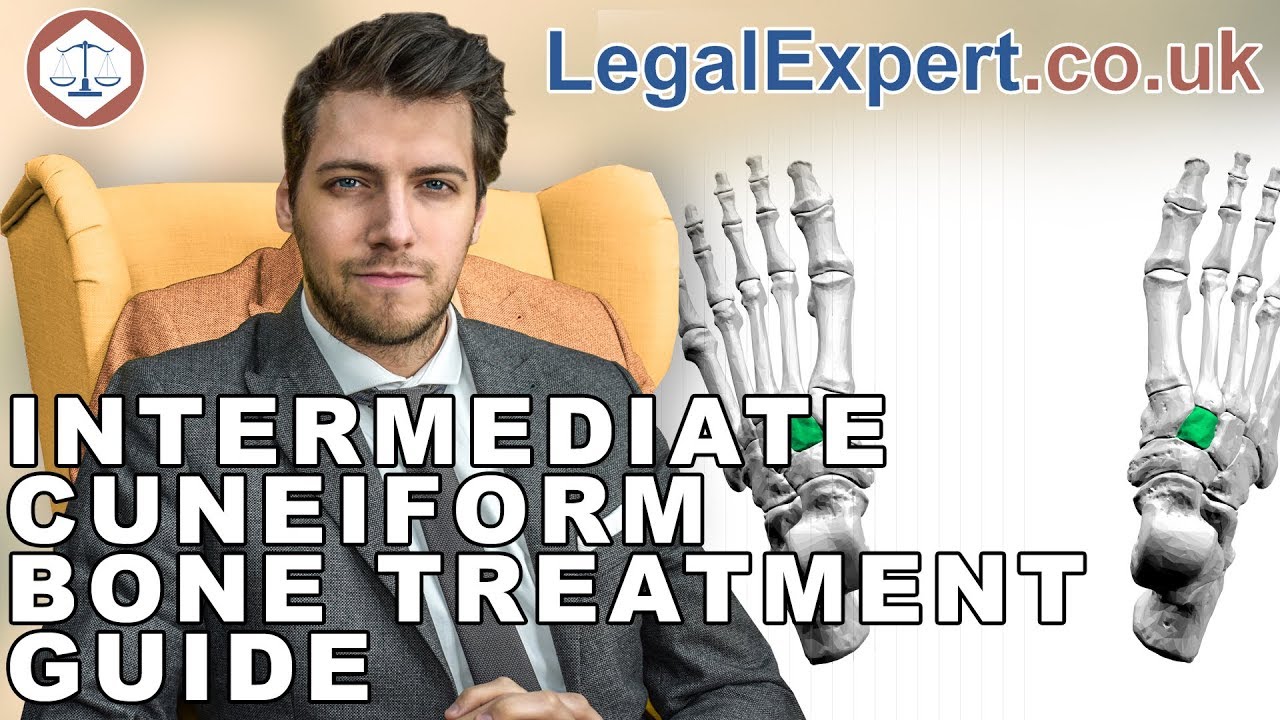 Intermediate Cuneiform Bone Injury Treatment Guide ( 2019 ) UK