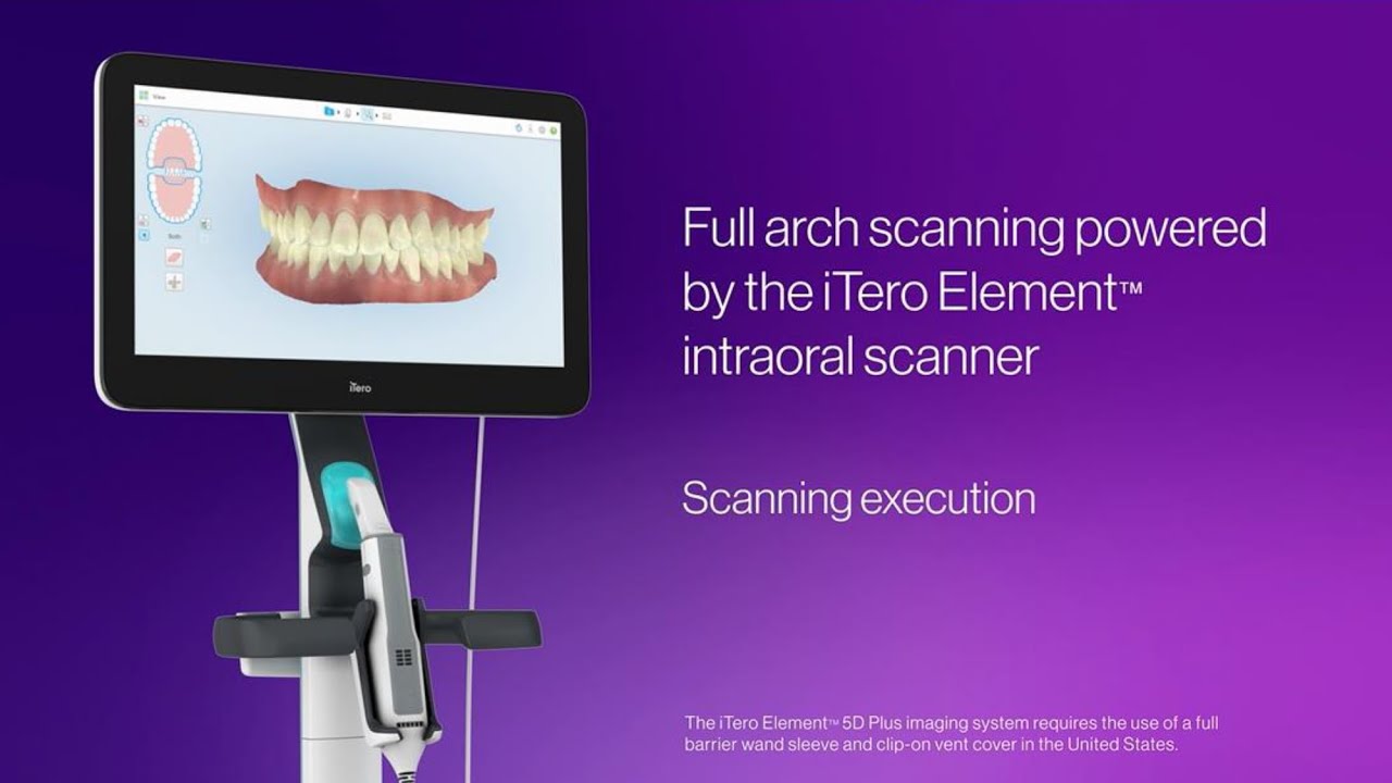 How to scan a full arch with the iTero Element&trade; Plus scanner | step-by-step execution