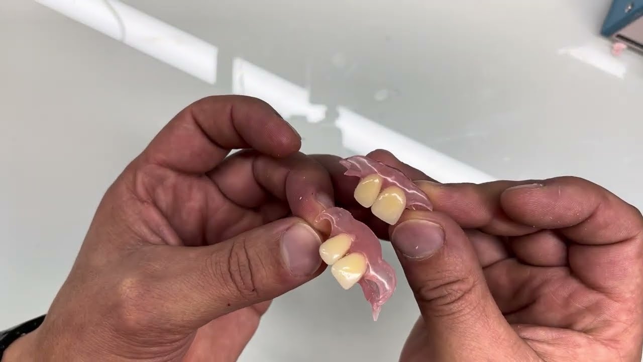 PRÓTESIS DENTAL FLEXIBLE DE 2 DIENTES 