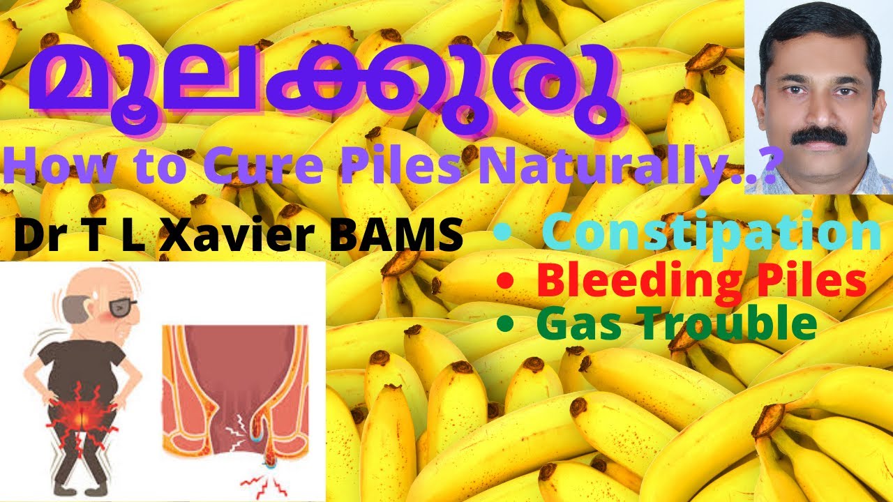 Piles | Hemorrhoids |  അർശസ് | ലക്ഷണങ്ങളും ചികിൽസയും | Dr T L Xavier | Ayurvedic Treatment