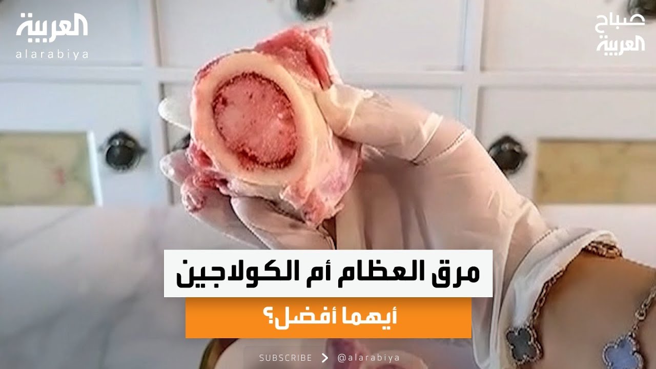 مرق العظام أم الكولاجين.. أيهما أفضل؟