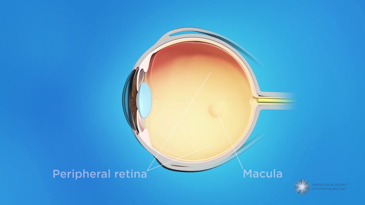 What is retinopathy of prematurity (ROP)?