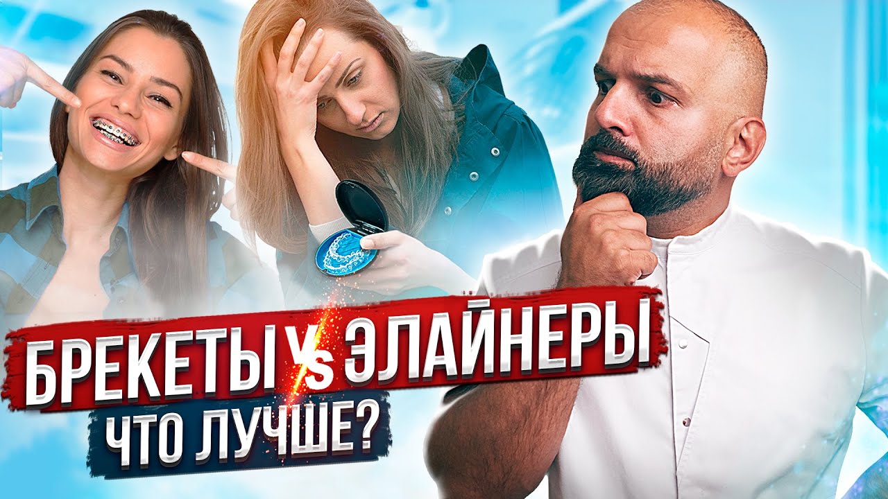 ЭЛАЙНЕРЫ или БРЕКЕТЫ - Что Выбрать? В чем разница между ЭЛАЙНЕРАМИ и БРЕКЕТАМИ, что лучше?